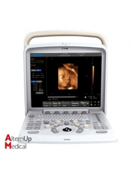 Chison Q5 Portable Ultrasound