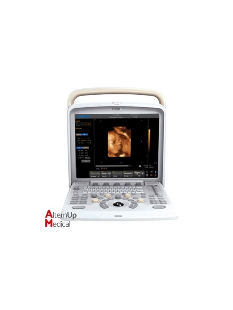 Chison Q5 Portable Ultrasound