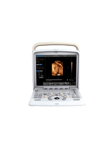 Chison Q5 Portable Ultrasound