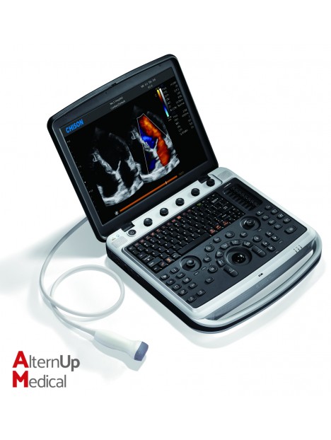 Chison SonoBook9 Portable Ultrasound