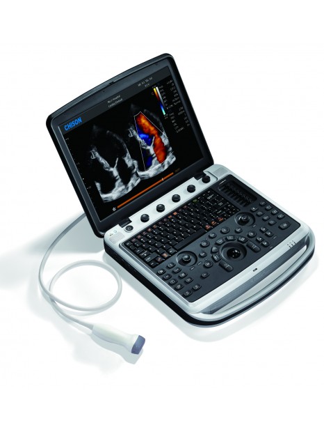 Echographe Portable Chison SonoBook9 
