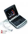 Echographe Portable Chison SonoBook9 