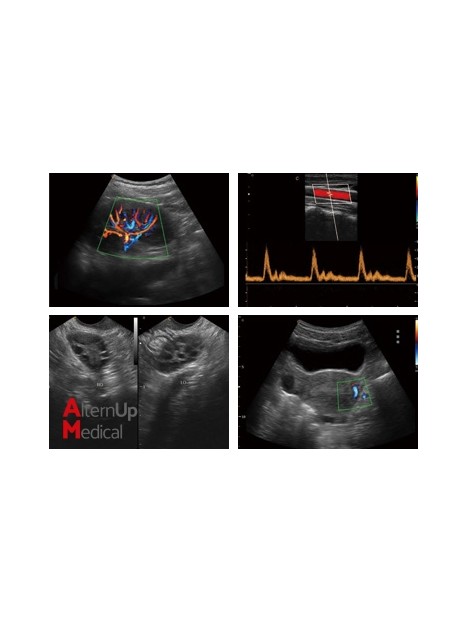 Chison Q5 Portable Ultrasound
