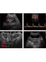 Chison Q5 Portable Ultrasound