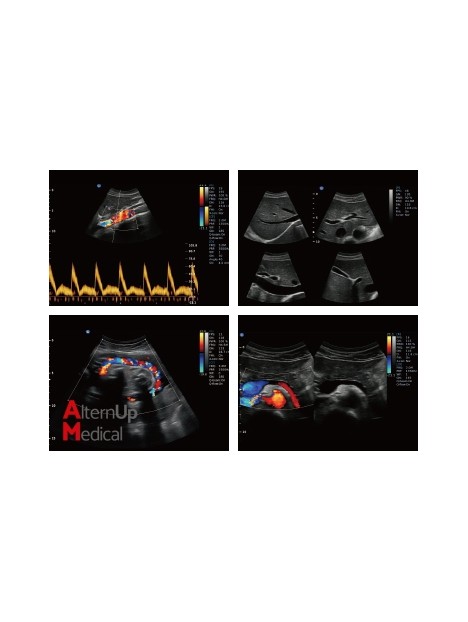 Chison EBit 50 Portable Ultrasound