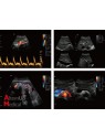 Chison EBit 50 Portable Ultrasound