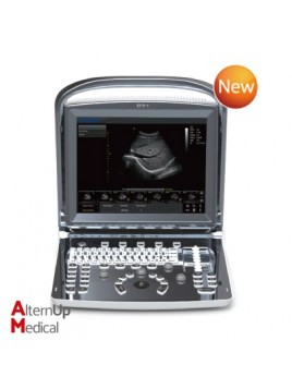 Chison ECO1 Portable Ultrasound