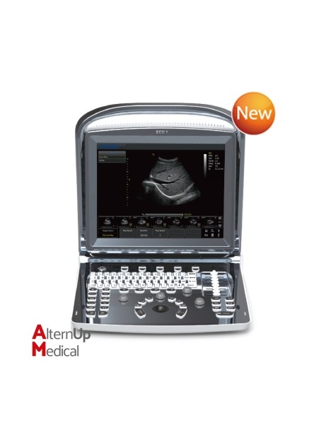 Chison ECO1 Portable Ultrasound