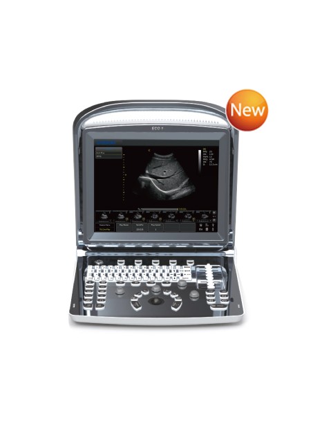 Chison ECO1 Portable Ultrasound