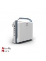 Chison ECO1 Portable Ultrasound