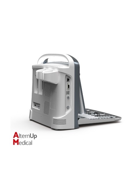 Chison ECO1 Portable Ultrasound