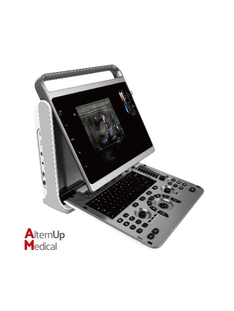 Chison EBit 50VET Portable Ultrasound