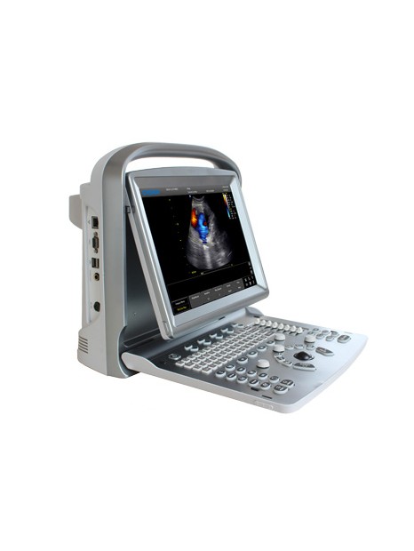 Chison ECO5 VET Portable Ultrasound