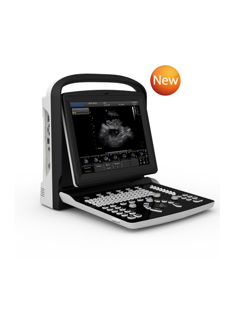 Echographe Portable Chison ECO3 VET Expert