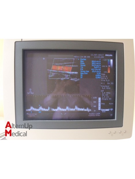 Echographe Cardiaque Philips HD11
