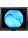 Colonne d'Endoscopie Fujinon System 4400