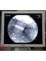 Fujinon System 4400 Endoscopy Column