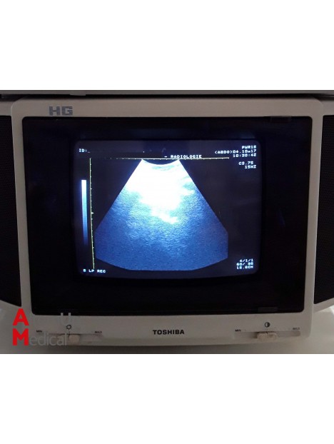 Echographe Toshiba SSH-140A