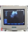 Siemens Sonoline G40 Ultrasound