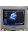 Siemens Sonoline G40 Ultrasound
