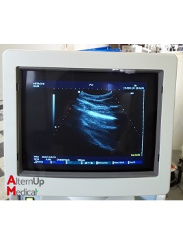 Echographe Hitachi EUB 6500