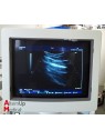 Hitachi EUB 6500 Ultrasound