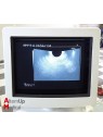 Echographe Hitachi EUB-525