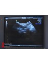 Echographe GE Voluson 730 Expert  BT05