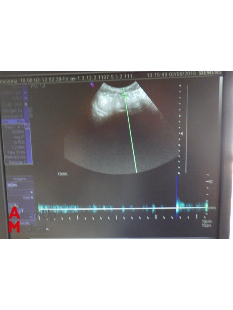 Echographe Siemens Sonoline Antares