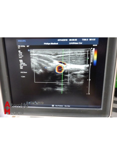 Philips iU22 3D Ultrasound