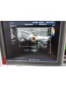 Philips iU22 3D Ultrasound