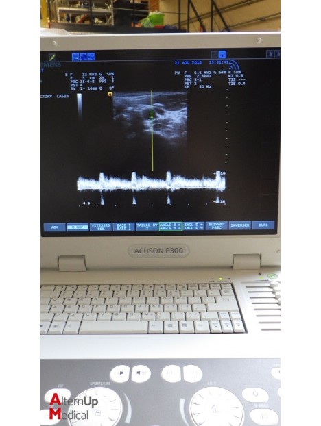 Echographe Portable Acuson P300