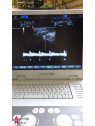 Echographe Portable Acuson P300