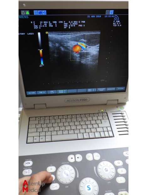 Echographe Portable Acuson P300