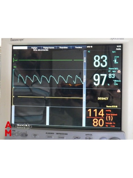 Taema Felix Anesthesia Ventilator
