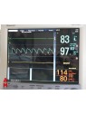 Taema Felix Anesthesia Ventilator