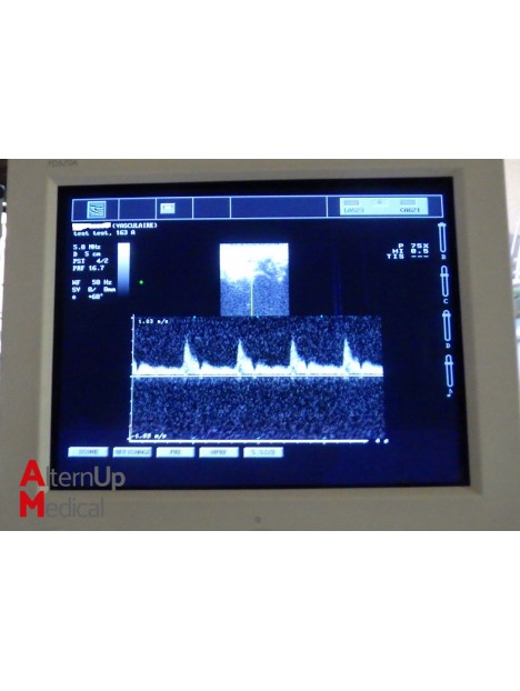 Echographe Esaote Caris Plus