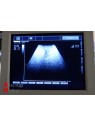 Echographe Esaote Caris Plus