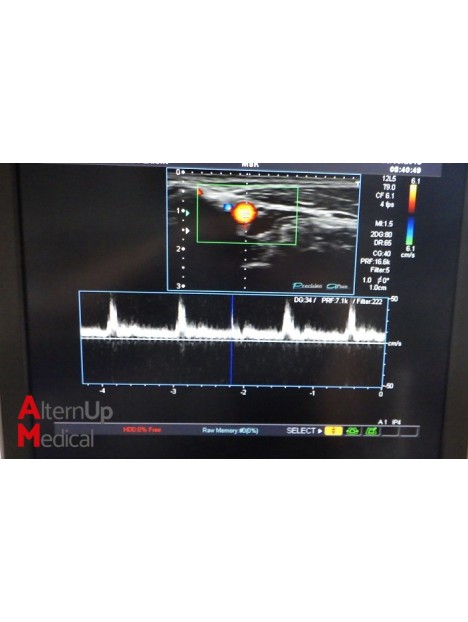 Toshiba Aplio MX SSA-780A Ultrasound