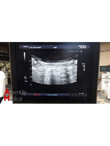 Toshiba Aplio MX SSA-780A Ultrasound