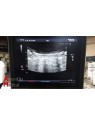 Toshiba Aplio MX SSA-780A Ultrasound