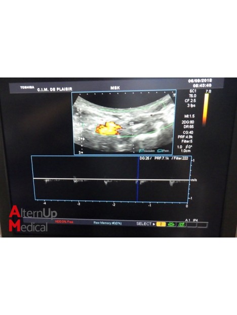 Toshiba Aplio MX SSA-780A Ultrasound