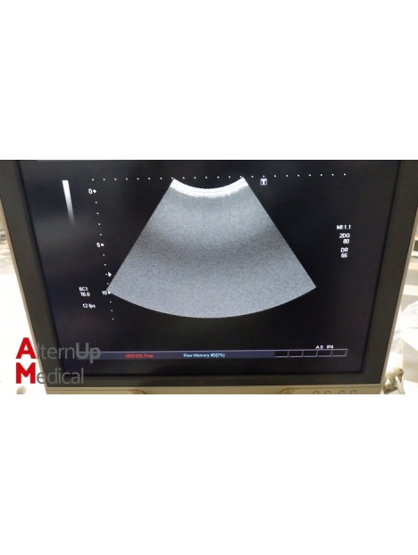 Toshiba Aplio MX SSA-780A Ultrasound