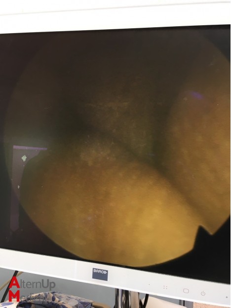 Olympus A2012A 30° Cystoscope