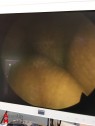 Olympus A2012A 30° Cystoscope