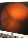 Olympus A4605A 30° Cystoscope