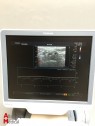 Toshiba SSA-790A Ultrasound