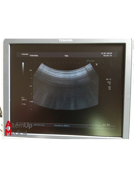 Toshiba SSA-790A Ultrasound