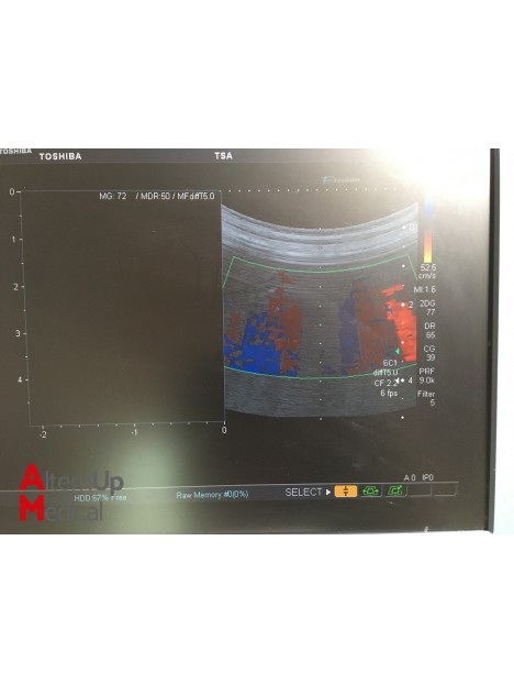 Toshiba SSA-790A Ultrasound