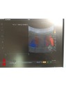 Toshiba SSA-790A Ultrasound